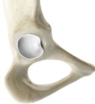 Hip Labral Tear