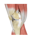 Knee Ligament Injuries