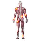 Musculoskeletal Injuries