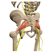 Piriformis Syndrome