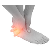 Treatment of Foot and Ankle Sports Injuries